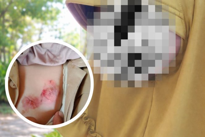 
 Kasus dugaan kekerasan anak di Lebak mencuat, korban mengaku dicakar, disiram air panas hingga kerap tidak diberi makan