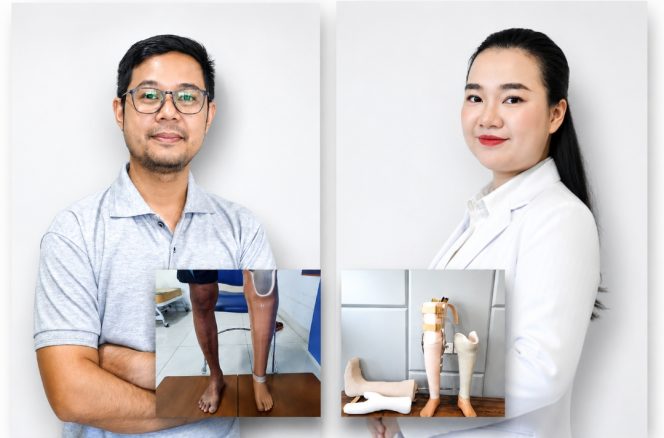 
 Layanan Rehabilitasi Medik RSUD Kota Tangerang Bantu Pasien Kembali Aktif dengan Dukungan Prostetik dan Ortotik Modern